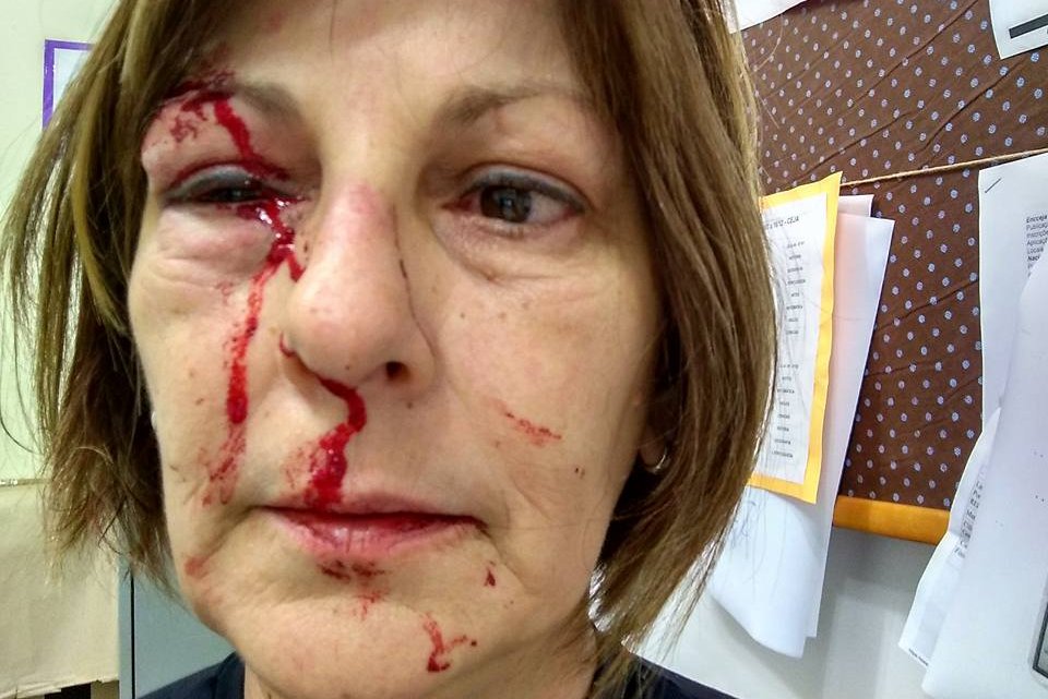 Professora tem rosto dilacerado por aluno de 15 anos em escola