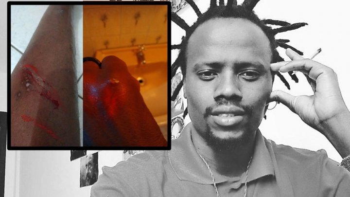 Haitiano é agredido pela terceira vez em Chapecó