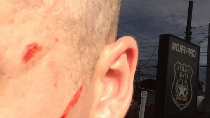 Homem transtornado ataca vizinhos e fere policial