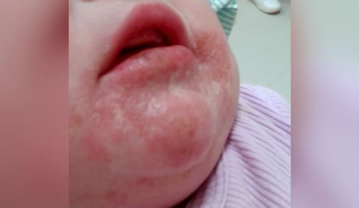 Pai teria usado soda cáustica para asfixiar bebê