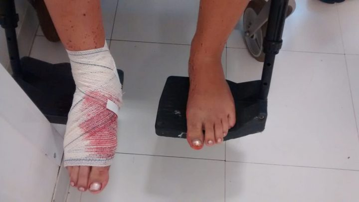 Irmão atinge o pé da irmã com disparo de calibre 12 no interior de Chapecó