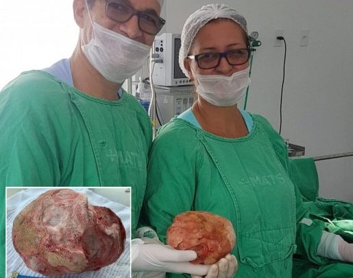 Lavrador de 51 anos tem pedra de 1,3 Kg retirada da bexiga