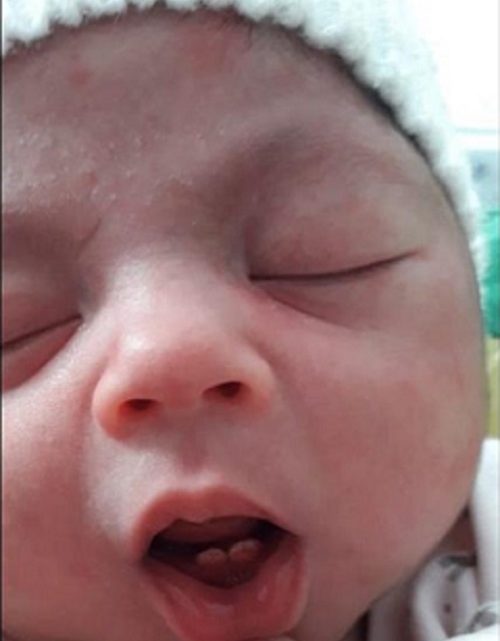 Bebê nasce com dois dentes e surpreende os pais em SC