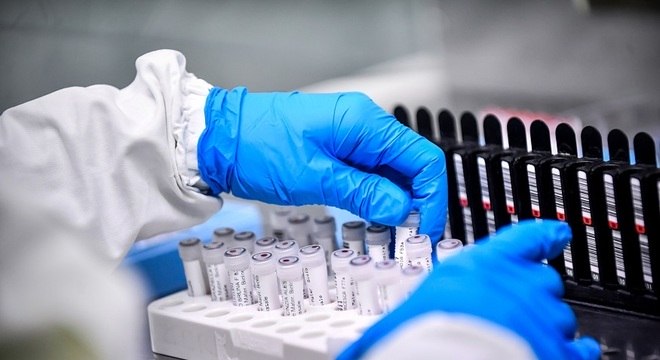 Número de novos casos de coronavírus cai pelo terceiro dia no Brasil