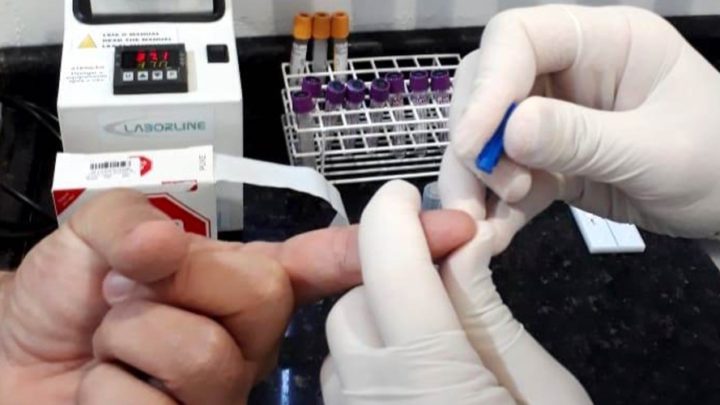 Chapecó receberá mais 160 testes rápidos para diagnóstico de coronavírus