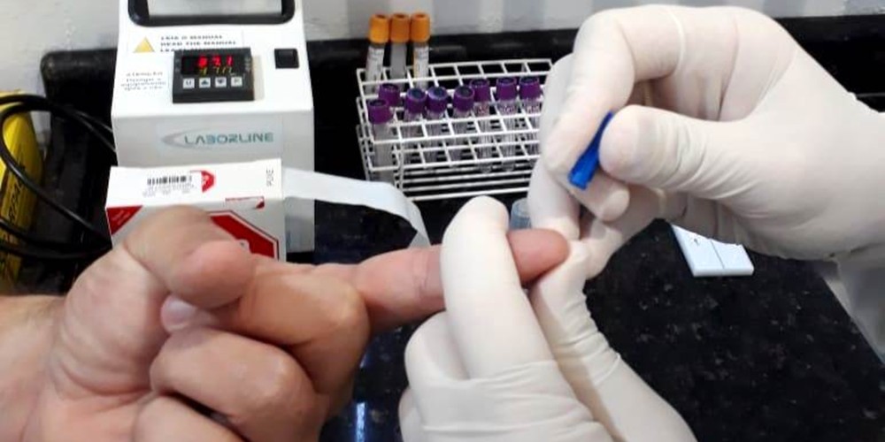 Chapecó receberá mais 160 testes rápidos para diagnóstico de coronavírus