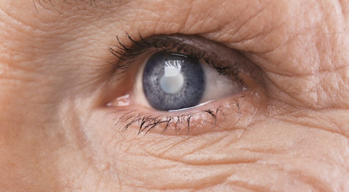 Dia de Combate ao Glaucoma alerta para prevenção à maior causa da cegueira