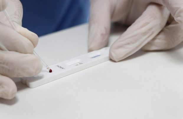 Governo de SC distribui 32 mil testes rápidos para Covid-19 aos municípios catarinenses