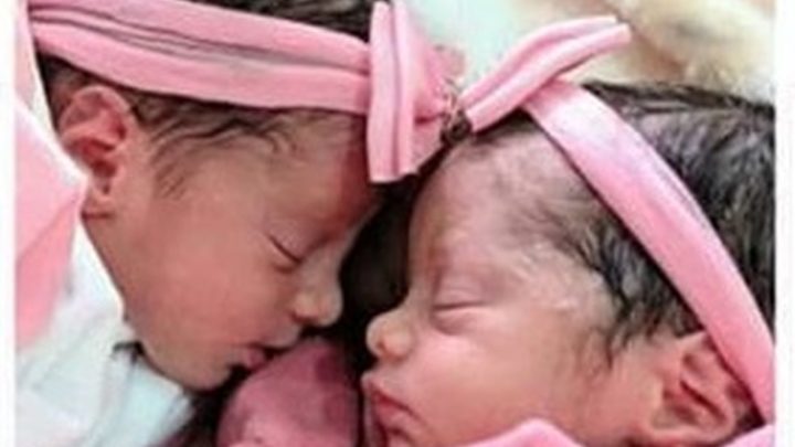 Recém-nascidas gêmeas morrem após serem atacadas por cachorro da família