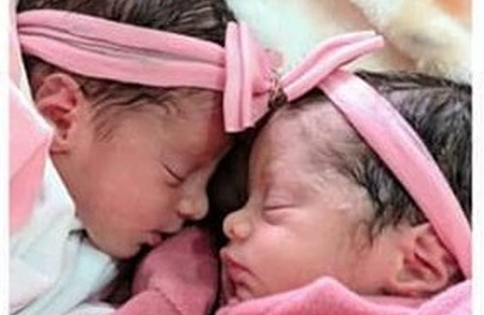Recém-nascidas gêmeas morrem após serem atacadas por cachorro da família