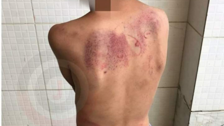 Mãe vai presa em Camboriú após espancar criança de 5 anos