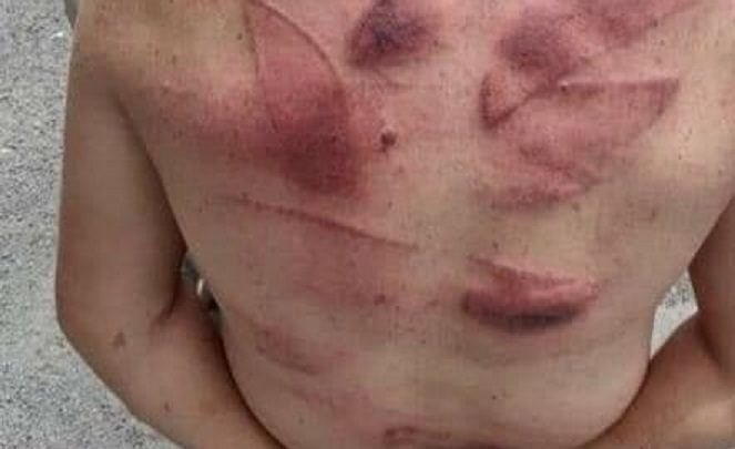 Homem é linchado após marcar encontro com criança de 12 anos no RS