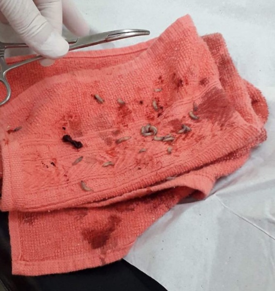 Homem que tinha mais de 300 larvas alojadas no rosto passou por cirurgia