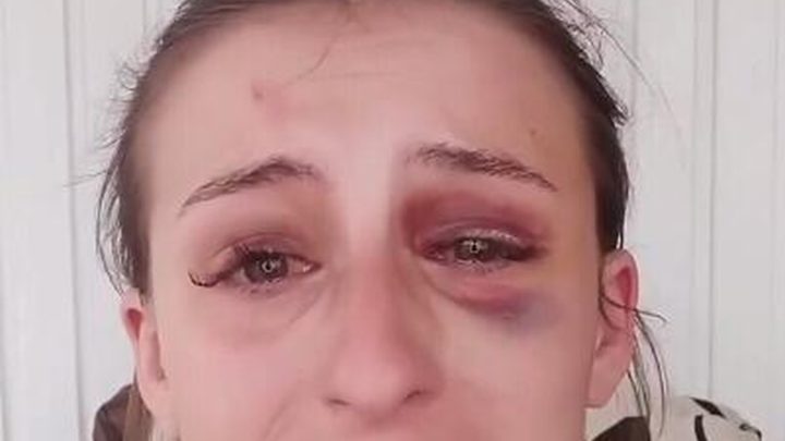 Maquiadora usa redes sociais para denunciar supostas agressões do namorado em SC