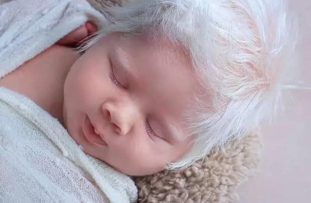 Bebê nasce com cabelos totalmente brancos e faz sucesso no interior gaúcho