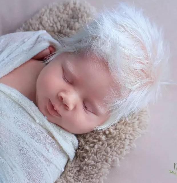 Bebê nasce com cabelos totalmente brancos e faz sucesso no interior gaúcho