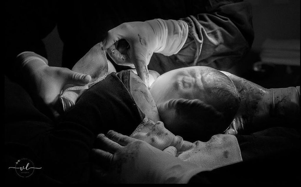 Fotos e vídeo: fotógrafa faz foto e vídeo de nascimento de bebê empelicado no Oeste de SC