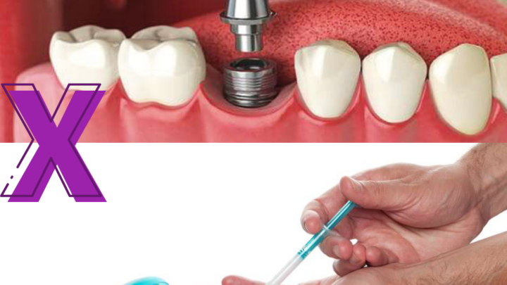 Tenho prótese dentária: Posso fazer clareamento?