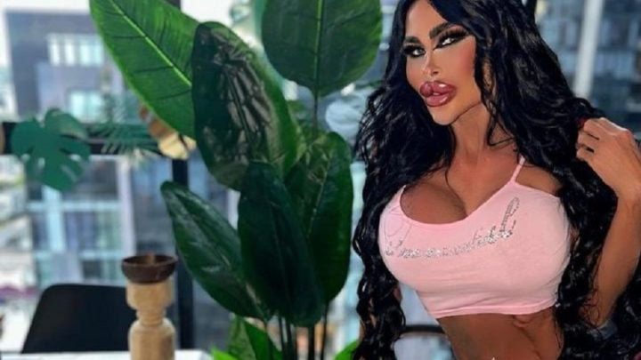 Digital Influencer gasta mais de 1 milhão em plástica para ficar parecida com Barbie