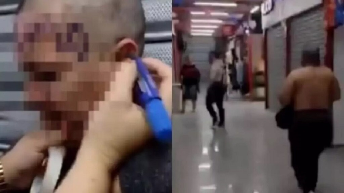 Mulher é agredida, tem o cabelo raspado e a palavra “ladra” escrita na testa por lojistas Mulher é agredida, tem o cabelo raspado e a palavra “ladra” escrita na testa por lojistas