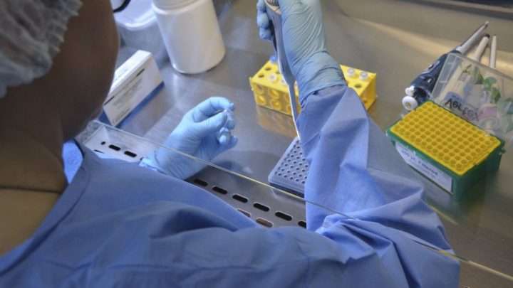 Italiano testa positivo para HIV, varíola dos macacos e Covid-19