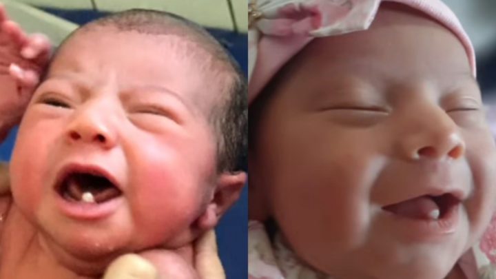 Vídeo: bebê nasce com dois dentes e vídeo viraliza nas redes
