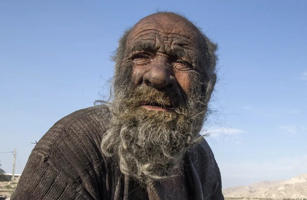 Homem conhecido como o mais sujo do mundo adoece e morre depois de tomar banho