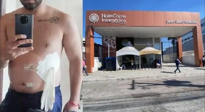 Médico coloca luva no lugar de bolsa de colostomia em paciente