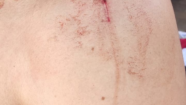 Homem não aceita que mulher reatou com o ex-marido e ataca casal com capacete e faca em SC