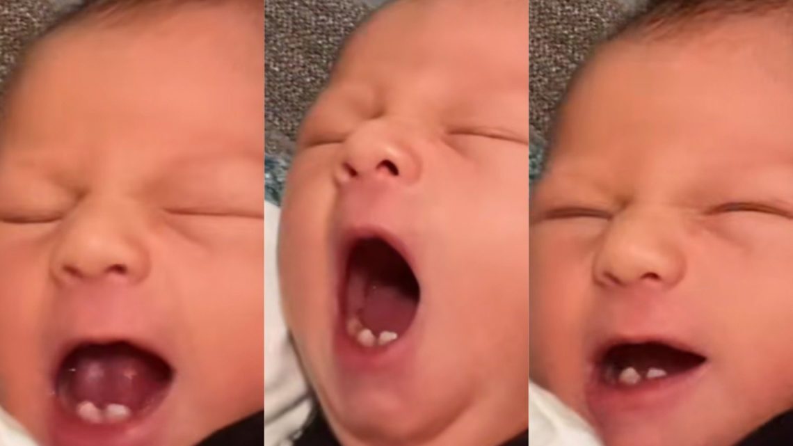 Vídeo: bebê nasce com dentes e deixa equipe do hospital incrédula