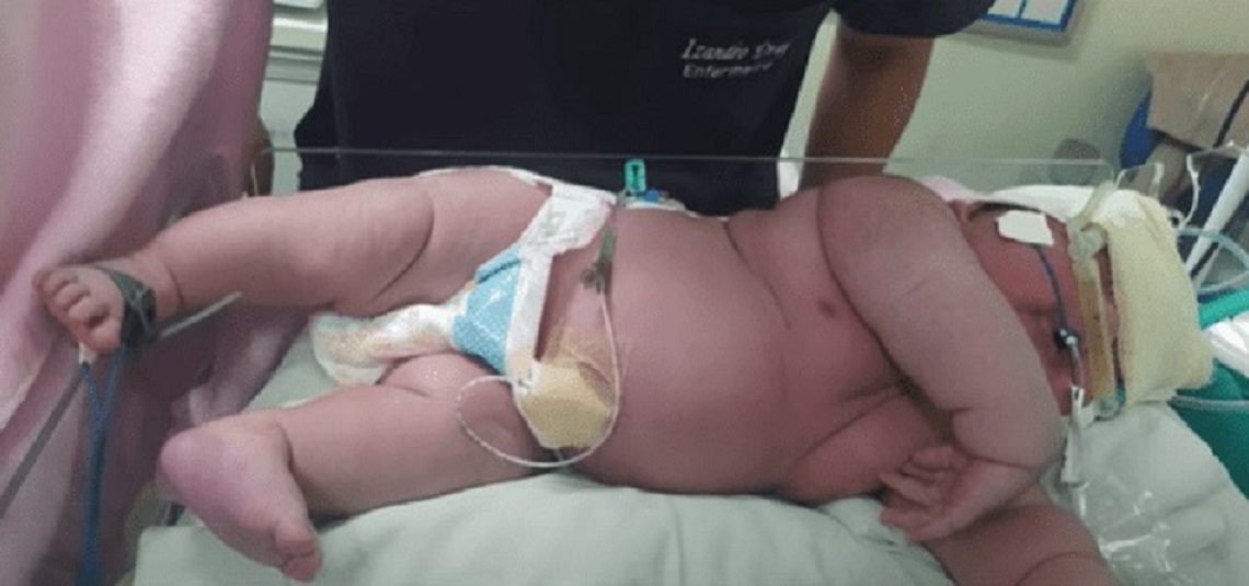 “Bebê gigante” nasce com mais de sete quilos e quase 60 centímetros