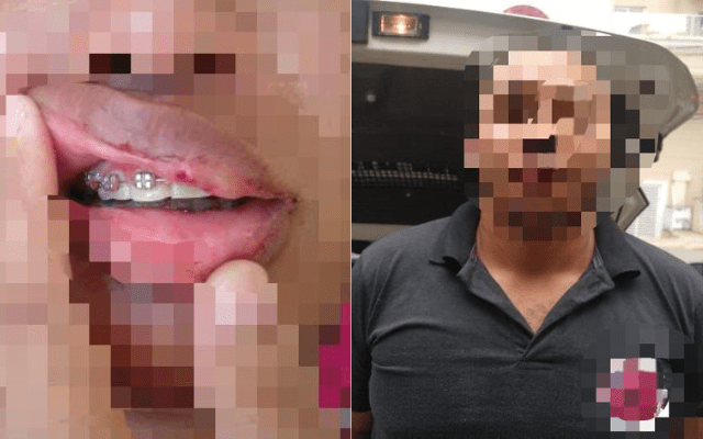Homem arremessa celular na boca da esposa em SC