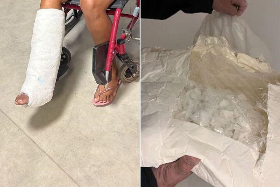 Mulher é presa com 3kg de cocaína escondida em gesso na perna