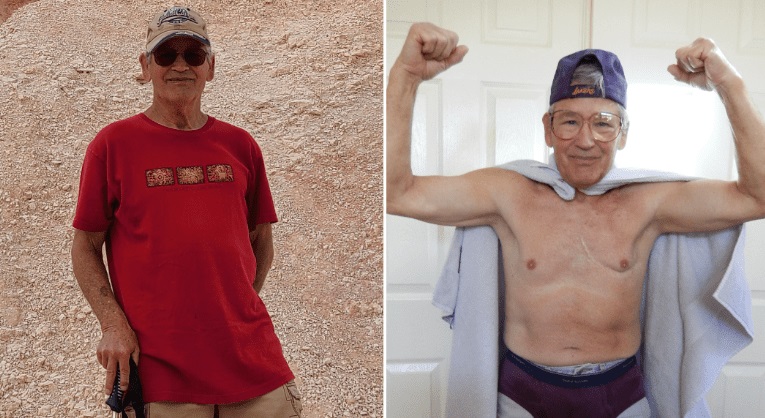 Idoso bate recorde por sobreviver 71 anos após cirurgia cardíaca