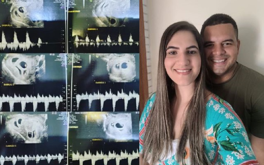 Mulher faz ultrassom para ver 1 bebê e descobre gravidez de sêxtuplos