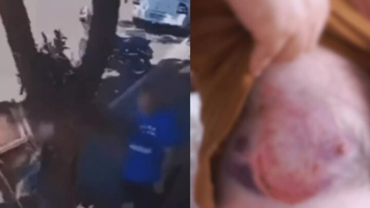 Vereador é mordido por burro enquanto andava por calçada; veja vídeo