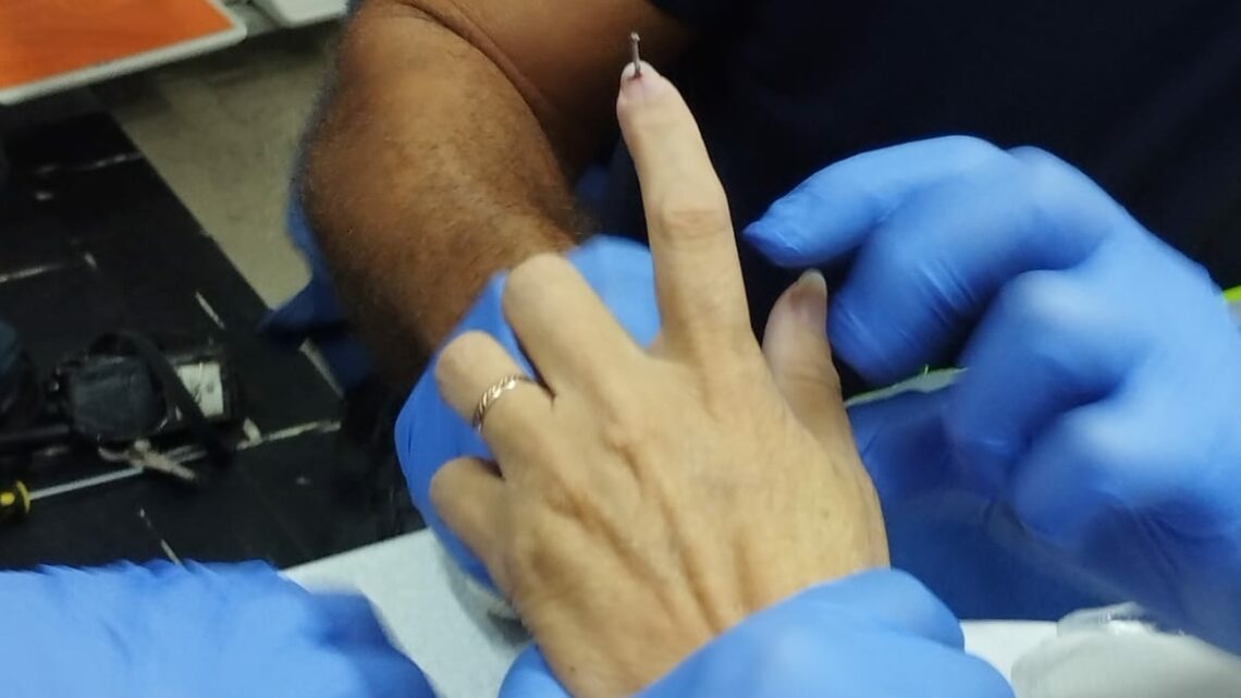 Costureira fica presa em máquina após agulha atravessar seu dedo