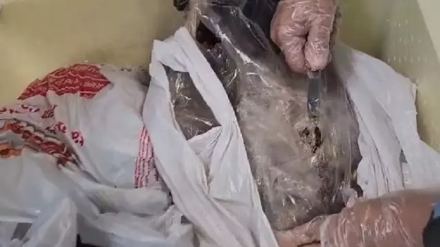 Homem é preso transportando drogas dentro de peixes