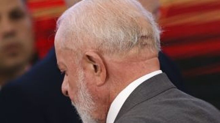 Lula passa por cirurgia de emergência após hemorragia no crânio
