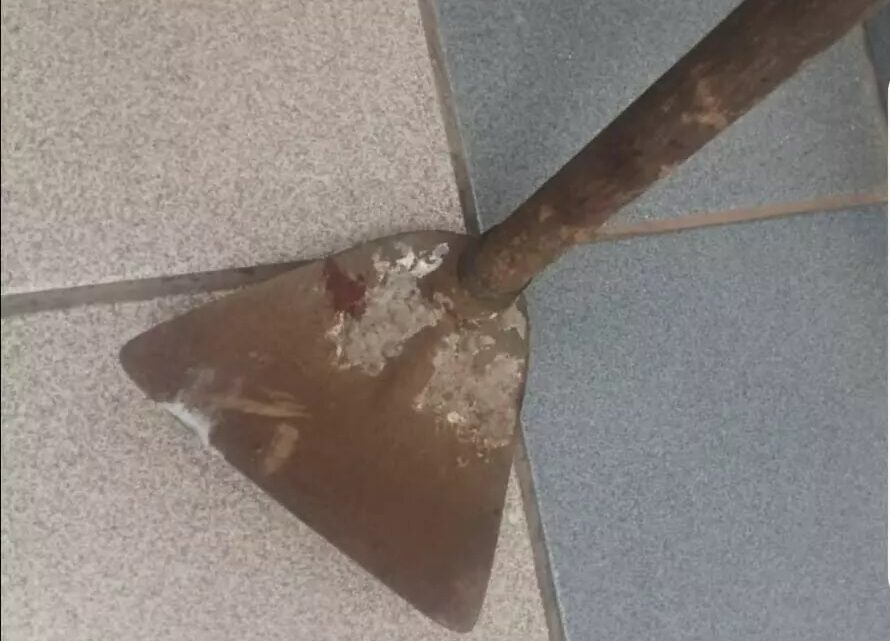 Mãe leva enxadada na cabeça pelo próprio filho após discussão em SC Mãe leva enxadada na cabeça pelo próprio filho após discussão em SC