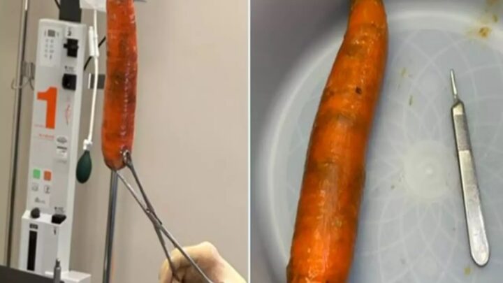 Homem busca socorro com cenoura de 20 cm presa no ânus