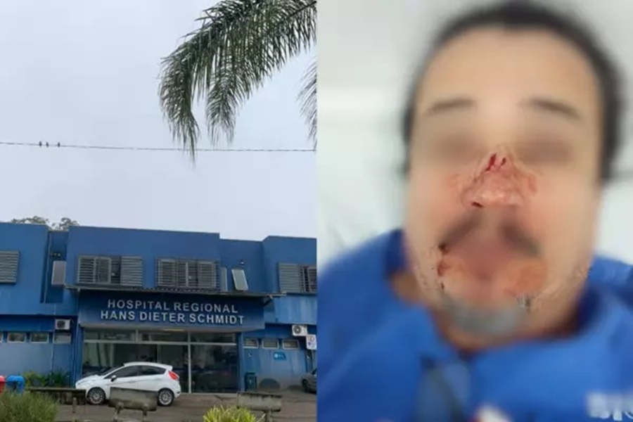 Técnicos de enfermagem são agredidos por acompanhante em hospital de SC: “uma coisa horrível” Técnicos de enfermagem são agredidos por acompanhante em hospital de SC: “uma coisa horrível”