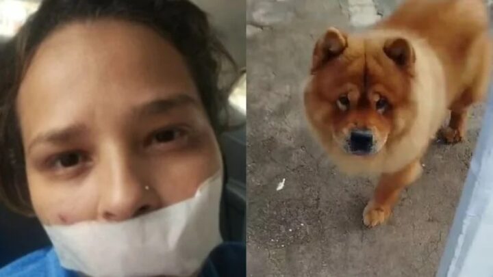 Cão é submetido à eutanásia após arrancar parte do lábio da dona