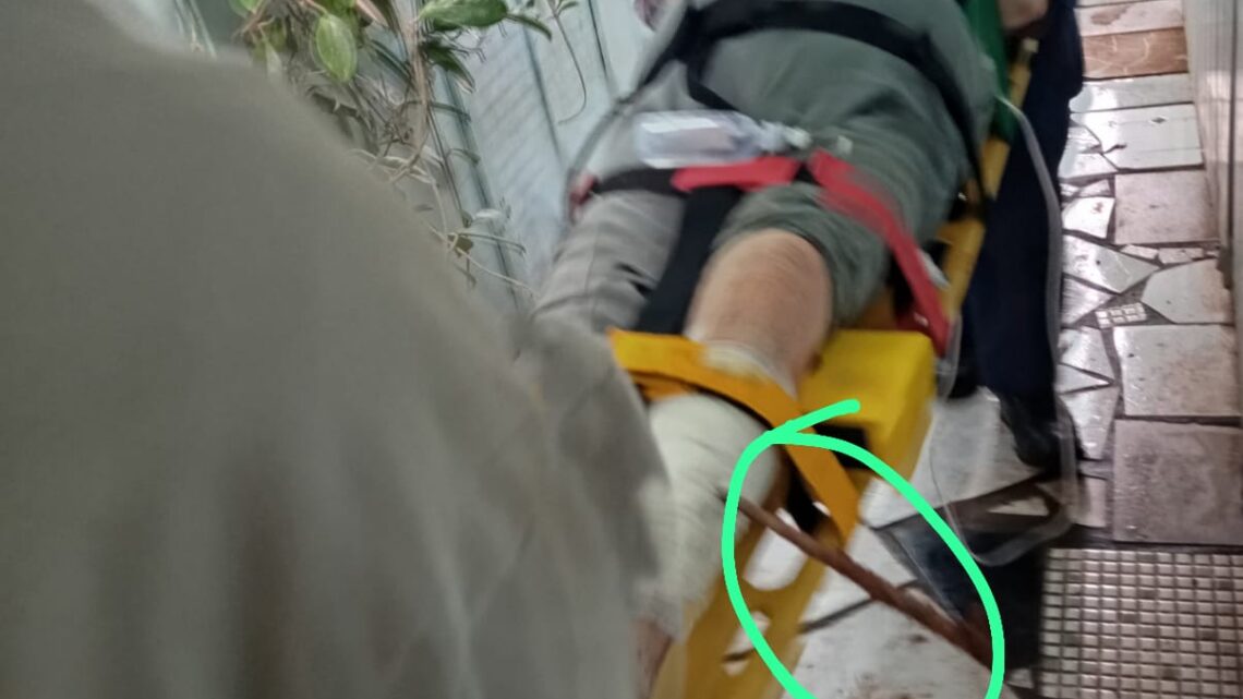 Idosa sofre queda e tem perna transfixada por vergalhão em Iporã do Oeste Idosa sofre queda e tem perna transfixada por vergalhão em Iporã do Oeste