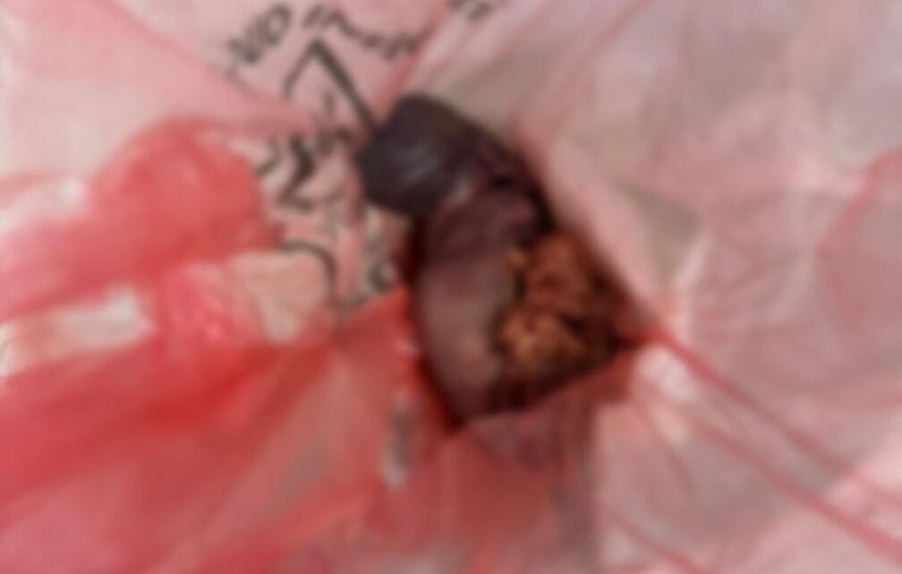 Casal é identificado após feto ser encontrado em banheiro de UPA de SC