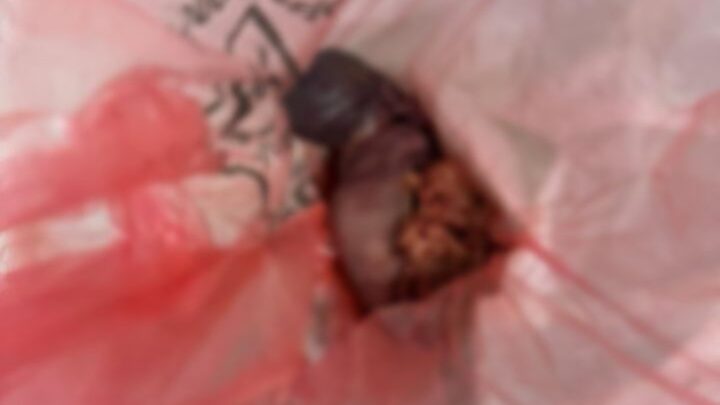 Casal é identificado após feto ser encontrado em banheiro de UPA de SC