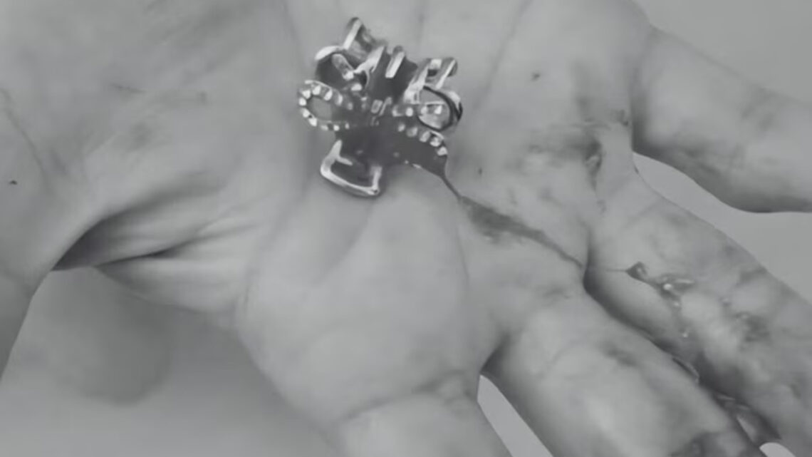 Criança de 2 anos é salva após se engasgar com prendedor de cabelo em SC