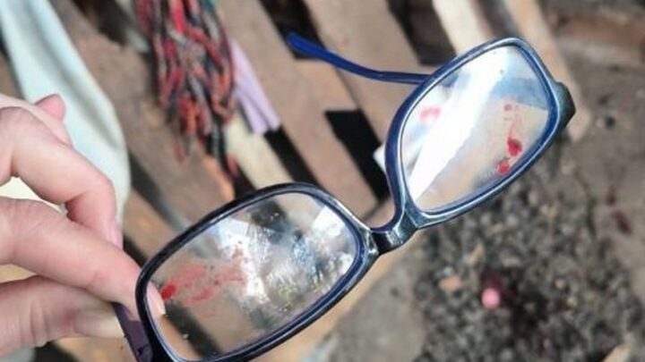 Idoso é esfaqueado durante assalto em residência no Oeste