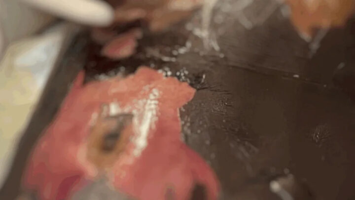 Condenado por cirurgias ‘X-Tudo’ médico tem três processos em dívida ativa no PROCON/SC