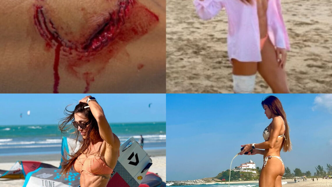 Turista é mordida por tubarão durante mergulho em Fernando de Noronha; veja o vídeo